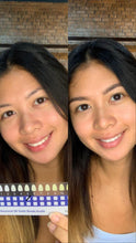 Load image into Gallery viewer, Jenny&#39;s Teeth Whitening Kit