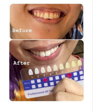 Load image into Gallery viewer, Jenny&#39;s Teeth Whitening Kit