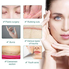 Load image into Gallery viewer, Advanced Skincare Sheets for C-sections, Keloids and Hypertrophic Scars