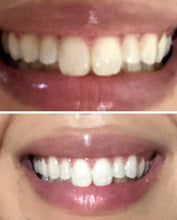 Load image into Gallery viewer, Jenny&#39;s Teeth Whitening Kit