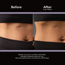 Load image into Gallery viewer, Advanced Skincare Sheets for C-sections, Keloids and Hypertrophic Scars