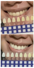 Load image into Gallery viewer, Jenny&#39;s Teeth Whitening Kit