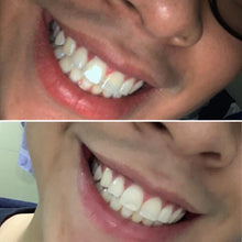 Load image into Gallery viewer, Jenny&#39;s Teeth Whitening Kit