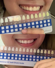 Load image into Gallery viewer, Jenny&#39;s Teeth Whitening Kit