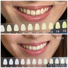 Load image into Gallery viewer, Jenny&#39;s Teeth Whitening Kit