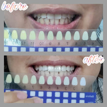 Load image into Gallery viewer, Jenny&#39;s Teeth Whitening Kit