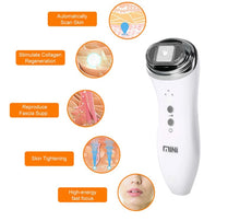 Load image into Gallery viewer, Lili Ultherapy - Collagen Regeneration