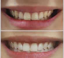 Load image into Gallery viewer, Jenny&#39;s Teeth Whitening Kit